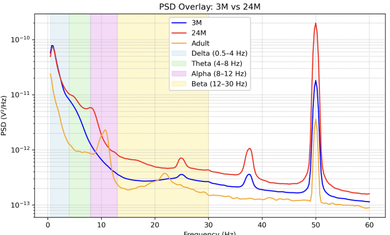 Power spectral density plot of the EEG samples from the Khula dataset